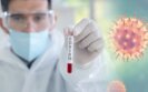 Fraudes relacionadas com o COVID-19 Coronavirus netSegura